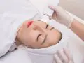cong nghe tri lieu da mat